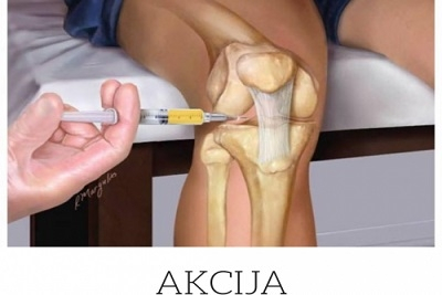  Tretman krvnom plazmom (prp) kolena, Popusti