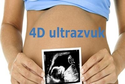 4D ultrazvuk za trudnice