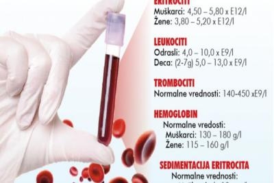 Analiza krvi i urina | Mojidoktori.rs