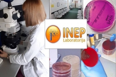 Prošireni paket briseva za žene u laboratoriji INEP za 1950 din na dve lokacije - Zemun i Slavija